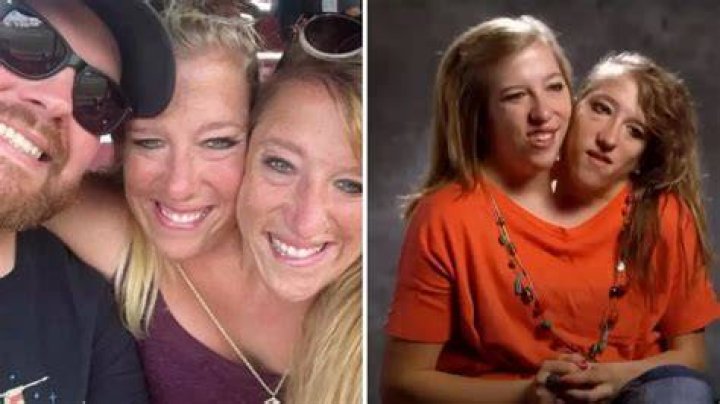 Abby And Brittany Hensel Pregnant Shea Willie