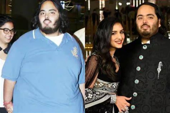 Anant Ambani reportedly gained weight due to steroids to treat his