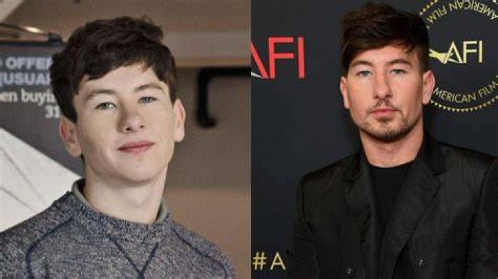 Barry Keoghan May Have Had Plastic Surgery To Fix His Face!
