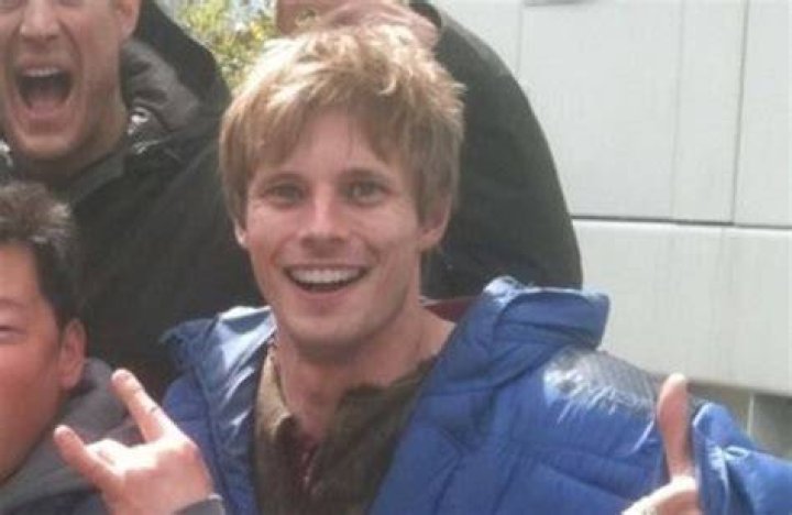 Did Bradley James Fix his Teeth? Why that's bad HubPages