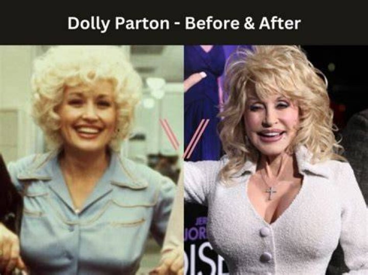 Dolly Parton from Celebrity Breast & Bra Sizes Revealed