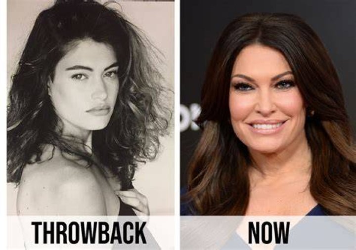 Kimberly Guilfoyle Before Surgery, Young Photos Age And