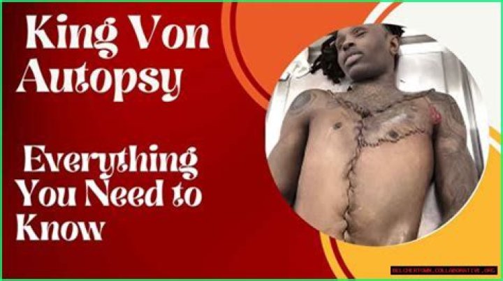 King Von Autopsy Photo Twitter BAHIA HAHA