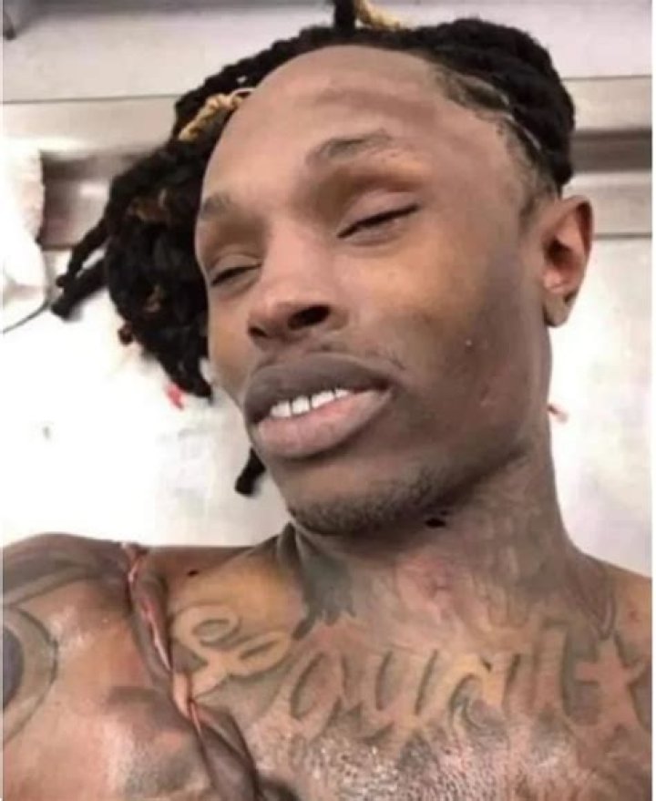King Von dead body pictures in hospital have hit the warning