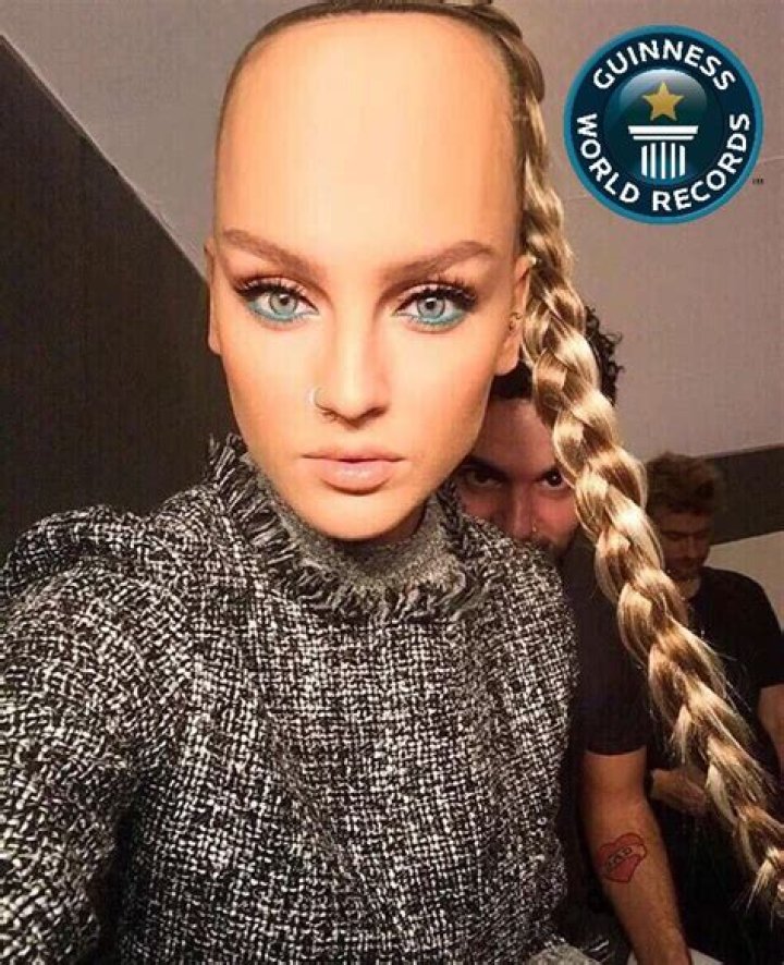 Largest Forehead In The World