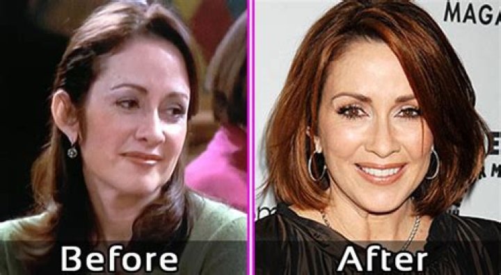 Patricia Heaton Plastic Surgery breasts(tits) and boobs