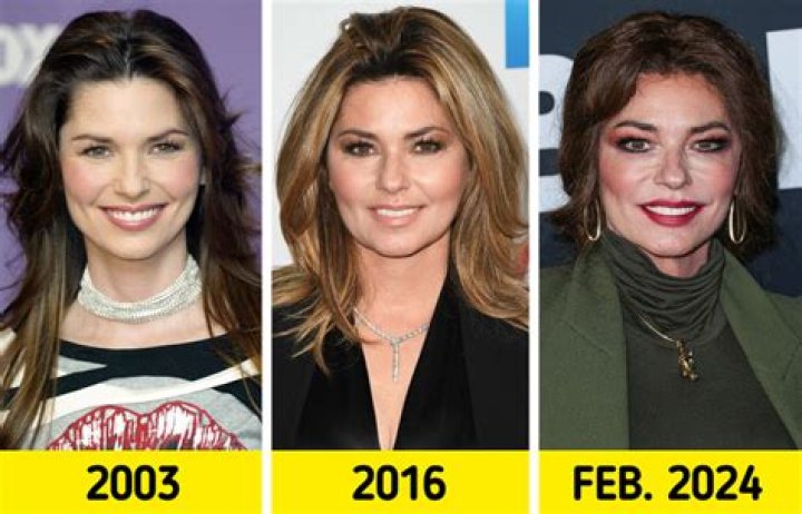 What Happened to Shania Twain’s Voice?