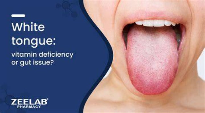 Which Vitamin Deficiency Causes White Spots on Skin? The Derm
